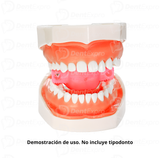 Retractor de Lengua American Ortho Tech Rosa